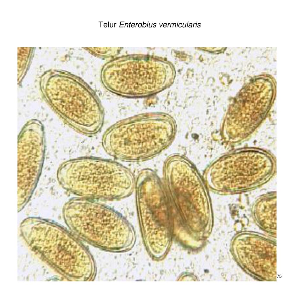 Enterobius vermicularis яйца